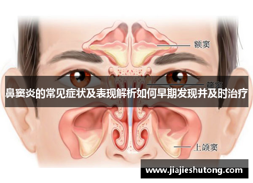 鼻窦炎的常见症状及表现解析如何早期发现并及时治疗